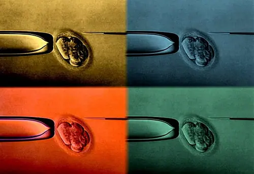 ¿Qué es la Biotecnología?